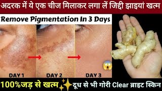 अदरक से झाइयां हटाने का कमाल का तरीका | Reduce Melasma,Pigmentation,Discolouration, Blackspots💕