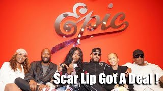 Scar Lip Signs To Epic Records !!