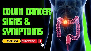 9 Key SIGNS \u0026 SYMPTOMS Of COLON CANCER You Should NEVER Ignore