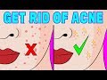 How to reduce acne naturally in 4 minutes a day