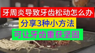 牙周炎导致牙齿松动怎么办？分享3种小方法，可让牙齿重获坚固