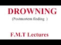Drowning ( Postmortem finding ) - F.M.T lectures