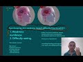 stroke ischemic stroke vs tia