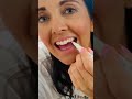 See instant whitening results, no matter where you are 🧳 #teethwhiteningpen #whiteteeth #yellowteeth