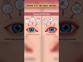 Causes of pink eye | Conjunctivitis | Redness of eye | Mk dedication | pink eye symptoms