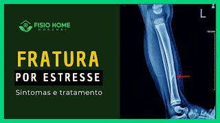 Fraturas por estresse - sintomas e tratamento - Fisio Home Morumbi