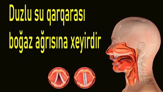 Duzlu suyun faydaları -Duzlu su qarqarası