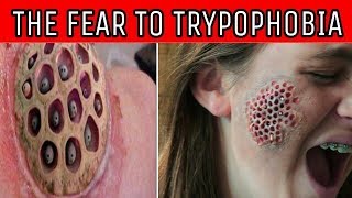 SECOND NAME OF FEARS - 👻☠️💀TRYPOPHOBIA💀☠️👻[Part-1] 2017