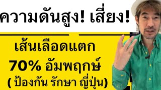 ความดันสูง! เสี่ยง! เส้นเลือดแตก 70% อัมพฤกษ์( ป้องกัน รักษา ญี่ปุ่น)