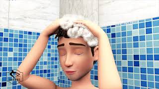 by by dandruff ! medical animation|sample use only by Dandelion Team