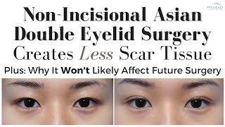 Why Non-Incisional Asian Eyelid Surgery Creates Less Scar Tissue, and Role of Scar Tissue in Healing