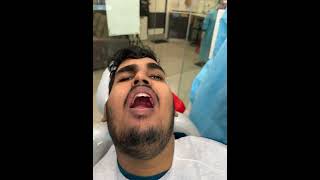 How to release lock jaw ? Clinical demo of a patient . Weak hearted don’t see this video .