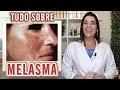 MELASMA - Como Clarear , Tratar e Prevenir essa Mancha de Pele !