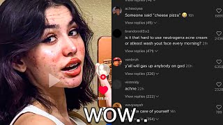 This TikToker Got Cancelled FOR BEING “UGLY”