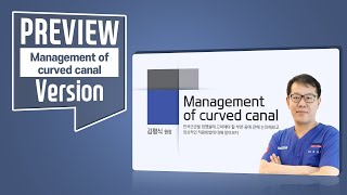 Management of curved canal - Preview