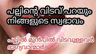 പല്ലിൽ വിടവുകൾ ഉണ്ടോ അവർ ഭാഗ്യവാന്മാർ|Teeth|Tooth|gap|teeth gap|astrology