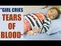 3 year old Hyderabad girl cries tears of blood | Oneindia News