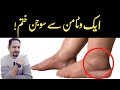 #1 Vitamin To Eliminate Swelling In Feet and Legs - Dr Irfan Azeem