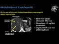 hepatic steatosis part 1 pathophysiology