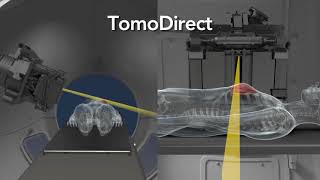 TomoTherapy - TomoTerapija - 3d prikaz