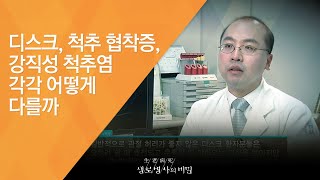 디스크, 척추 협착증, 강직성 척추염 각각 어떻게 다를까 - (20130309_451회 방송)_젊은 허리를 노린다, 강직성 척추염