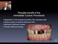 managing prosthetic components for predictable implant aesthetics part 1