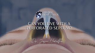 Can you live with a perforated septum?