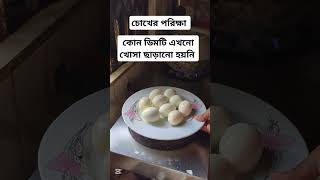 চোখের পরিক্ষা কোন ডিমটি এখনো খোসা ছাড়ানো হয়নি ⁉️