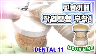 치과 관교의치 교합기에 작업모형 부착과정(mounting) 핀작업[덴티에듀, DentiEDU] [4K]