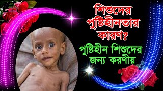 শিশুদের পুষ্টিহীনতার কারণ? পুষ্টিহীন শিশুদের জন্য করণীয়, ডা: কাজী জামির হোসেন.সহযোগী অধ্যা II ASWMC