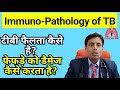 TB kaise failta hai // How tuberculosis spread // Pathogenesis of TB // Dr Sanjay chest specialist