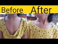 How to fix low neckline T-shirt |T shirt collar repair|how to raise low neckline T shirt