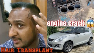 Ford 3600 40000 vale da engine block crack hai | Hair Transplant treatment | Party 10k subscribers