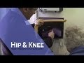 Educating the Patient | Total Knee Replacement