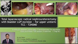 Total laparoscopic radical nephroureterectomy with bladder cuff excision in difficult abdomen