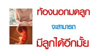 พบหมอเสรี ตอนที่ 360 : เคยเป็นท้องนอกมดลูก จะมีลูกได้อีกมั้ย