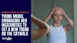 Young Model Embracing Alopecia To Set A New Trend On The Catwalk