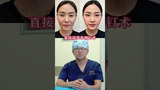 青春铆钉术了解方式在主页#抗衰 #抗衰老 #beauty #面部年轻化 #botox #变美小技巧 #面部提升