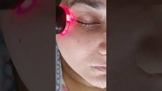 RF Skin Tightening Facial Step by Step | Neck Lift Face Lift Shrink Pores \u0026 Blackheads Removal