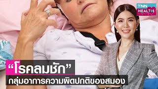 “โรคลมชัก”กลุ่มอาการความผิดปกติของสมอง l TNN Health l 24 12 65