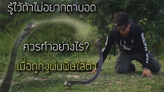 รู้ไว้ถ้าไม่อยากตาบอด ถ้าถูกงูพ่นพิษใส่ตาควรทำอย่างไร?