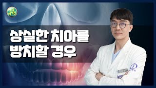 [건강매거진] #02. 상실한 치아를 방치할 경우!!