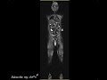 3 Tesla WHOLE BODY MRI