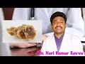 how to identify ganja weed addiction గంజాయి weed దురలవాటు ని ఎలా గుర్తించాలి. by dr. hari kumar