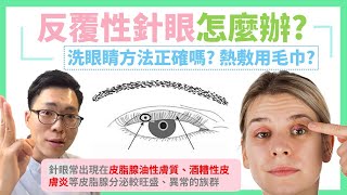 針眼反覆發作怎麼辦？第一次長針眼除了吃抗生素，熱敷只能用毛巾嗎？ 清洗眼睛不可缺少的法寶，擺脫反覆性針眼