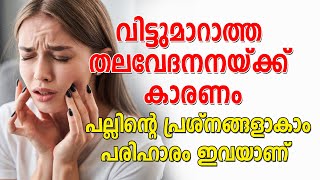 Dental Health and Headaches | വിട്ടുമാറാത്ത തലവേദനയ്ക്ക് കാരണം പല്ലിന്റെ പ്രശ്നങ്ങളാകാം