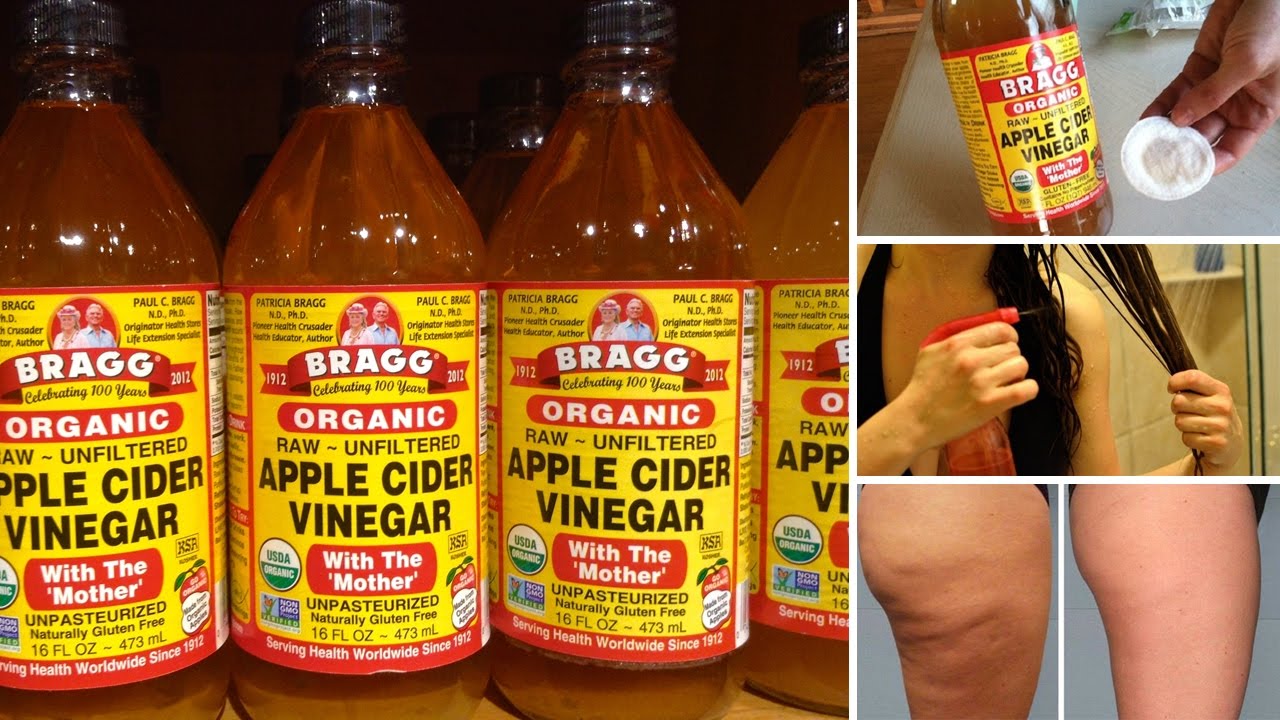 7 Surprising Beauty Benefits Of Apple Cider Vinegar - YouTube