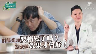 頭頂禿頭怎麼辦？頂部植髮這樣做｜澤林毛髮診所謝宗廷醫師