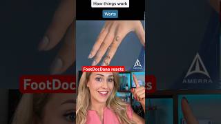 Doctor explains the science of warts