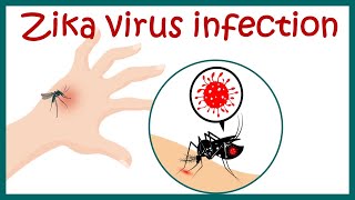 Zika Virus infection | causes \u0026 pathology | Amid COVID-19, Kerala reports first case of Zika virus